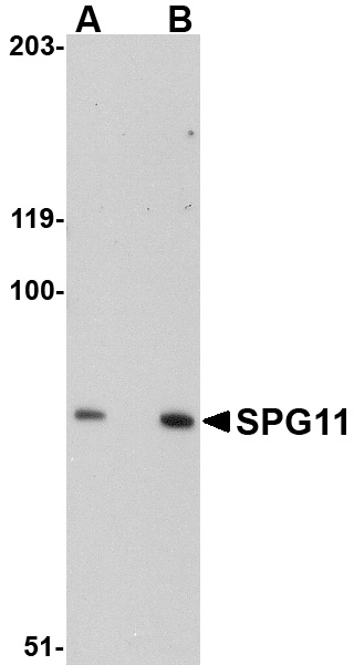SPG11 Antibody (OAPB00830) in Mouse Heart using Western Blot
