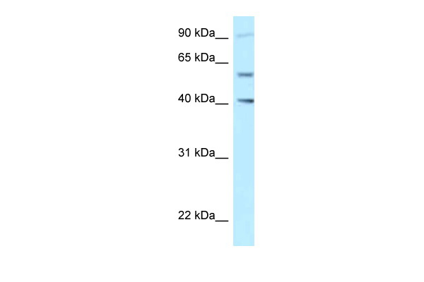 SHCBP1L antibody - C-terminal region (ARP53795_P050) in Human Jurkat using Western Blot