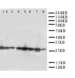 CISH Polyclonal Antibody (OABB00737) in Rat Liver,Kidney, Human Placental, A431, SMMC, HELA, COLO320, M231 using Western Blot