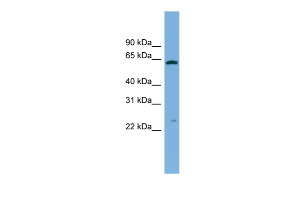 GSTA3 antibody - middle region (ARP48484_P050) in Human HCT15 using Western Blot
