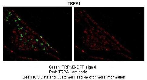 TRPA1 antibody - middle region (ARP35205_P050) in Mouse using Immunohistochemistry