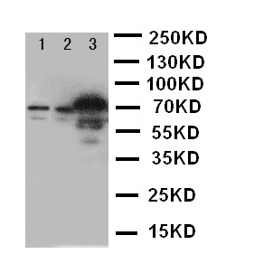 SLC6A4 Polyclonal Antibody (OABB00657) in U87, HELA, Jurkat using Western Blot