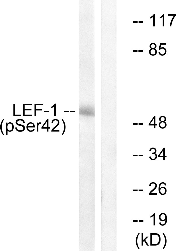 LEF1 Antibody (Phospho-Ser42) (OAAF00247) in 293 using Western blot.