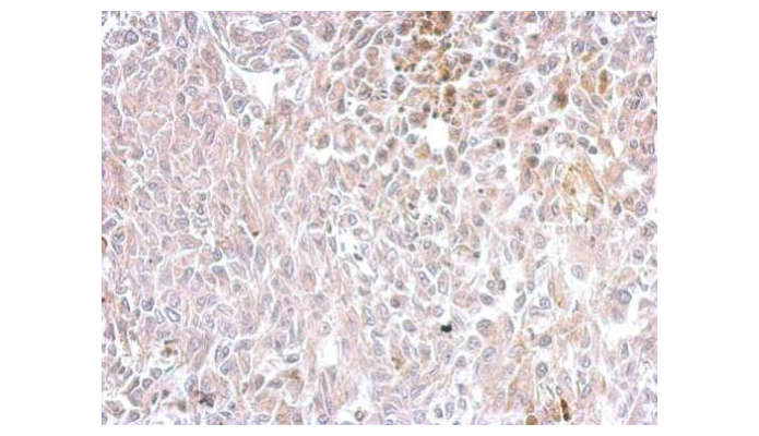 SCG2 antibody (OAGA01106) in rat RT2 Xenograft using Immunohistochemistry
