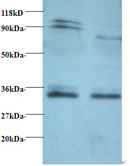 Rabbit anti-human Thiopurine S-methyltransferase (OACA00324) in EC109 , 293T using Western Blot