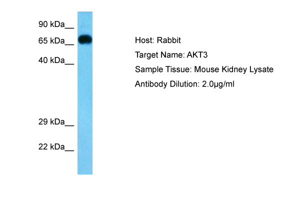AKT3 Antibody - C-terminal (ARP73692_P050) in Mouse Kidney  using Western Blot