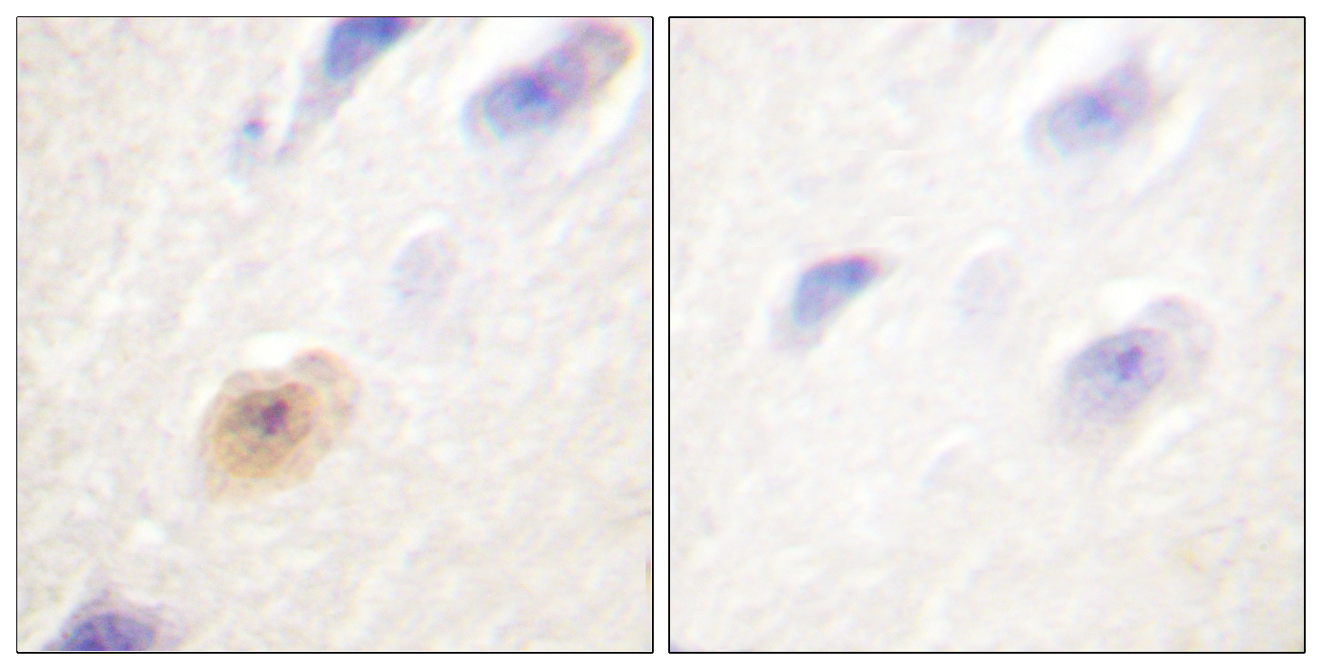 CSE1L Antibody (OAAF01749) in human brain tissue using Immunohistochemistry.