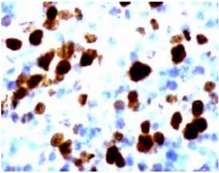 Rabbit Anti-Ki-67 Polyclonal Antibody(OAAI00135) in Human lymph node using Immunohistochemistry.