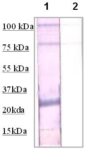 Rabbit Anti-Claudin 7 Polyclonal Antibody(OAAI00023) in Mouse Kidney using Western Blot.