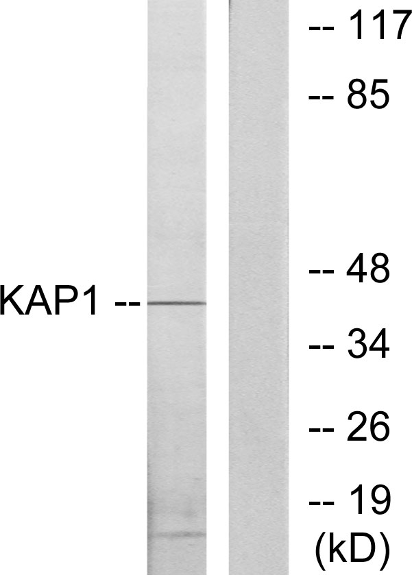 PRKAR1B Antibody (OAAF02229) in COLO205 using Western blot.