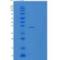 人骨结合蛋白/SPARC/BM-40重组蛋白C-6His