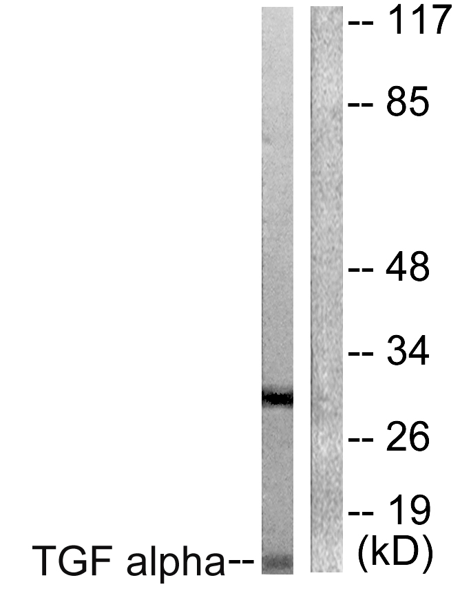 TGFA Antibody (OAAF01939) in COS7 using Western blot.