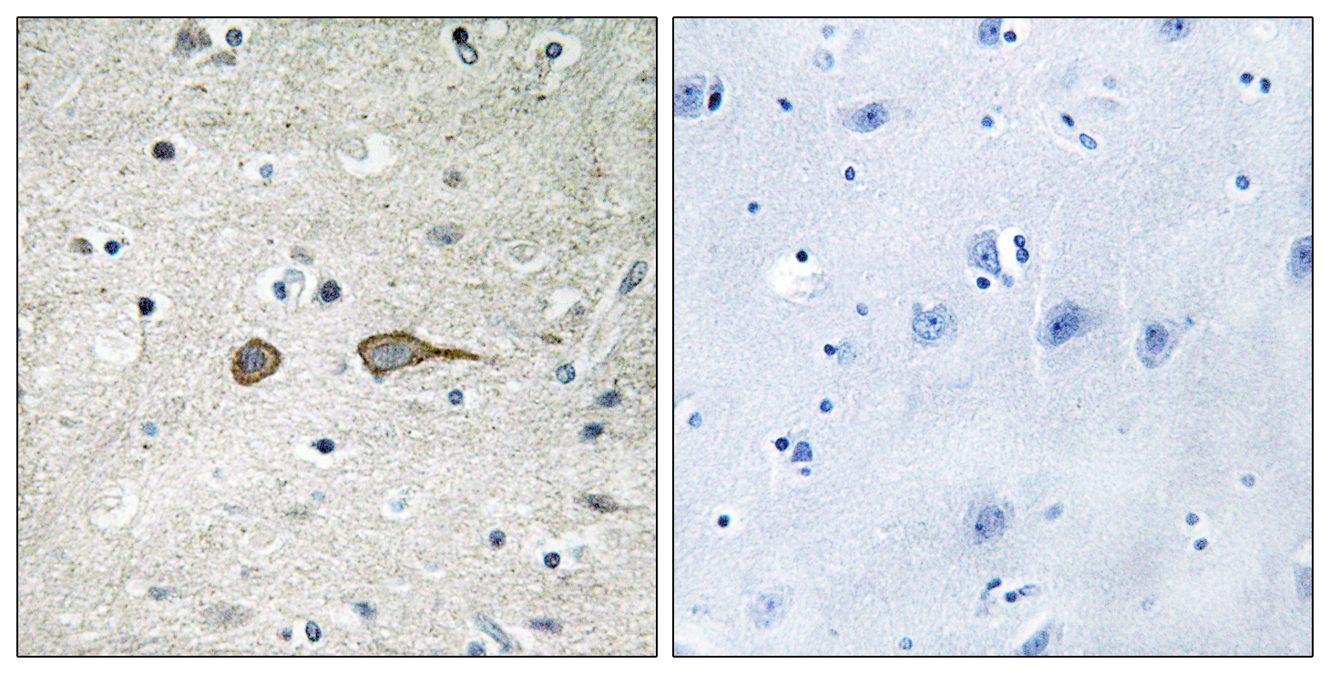 MADD Antibody (OAAF02577) in human brain tissue using Immunohistochemistry.
