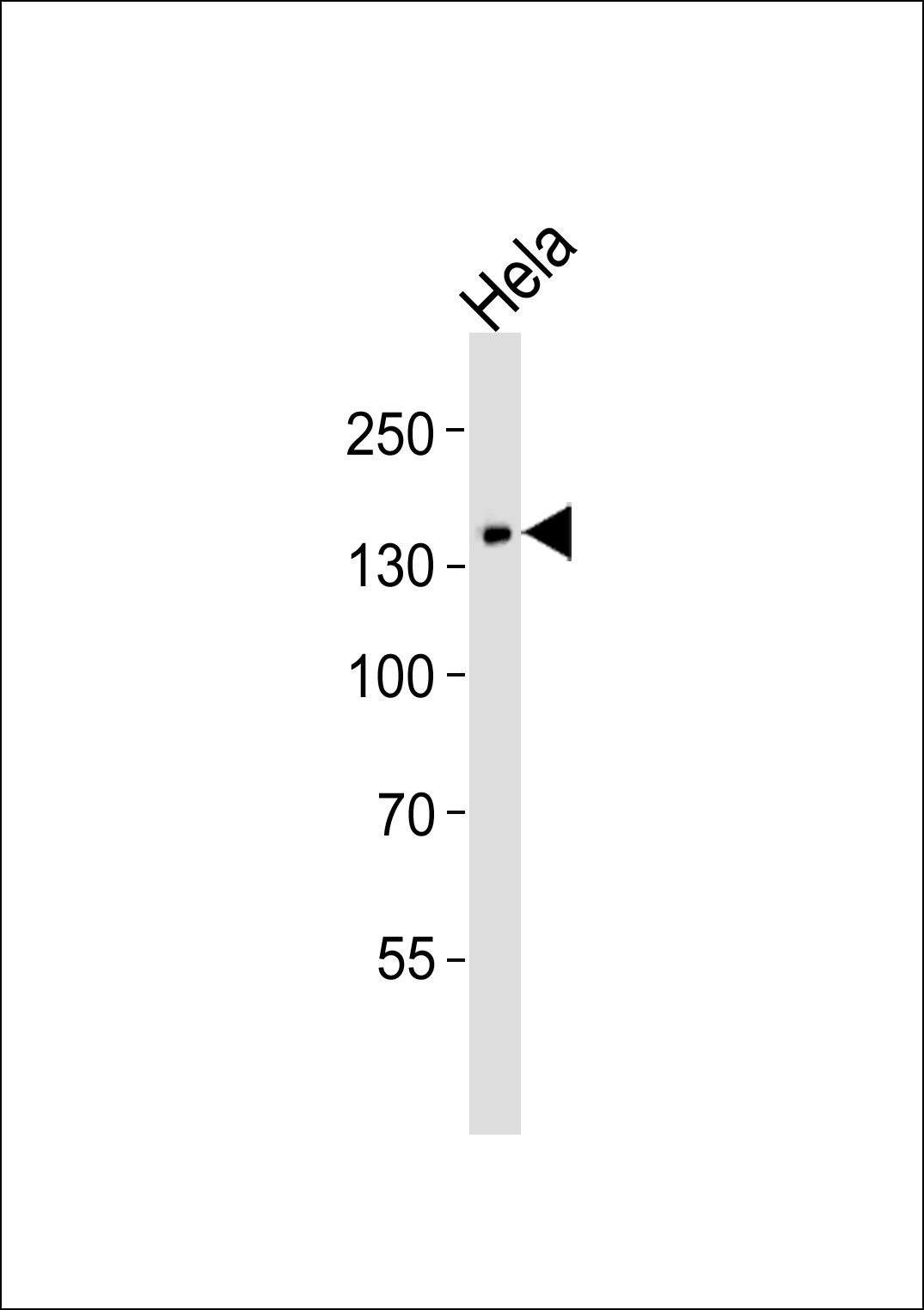PLCG1 Antibody (OAAB18291) in Hela cell line using Western Blot