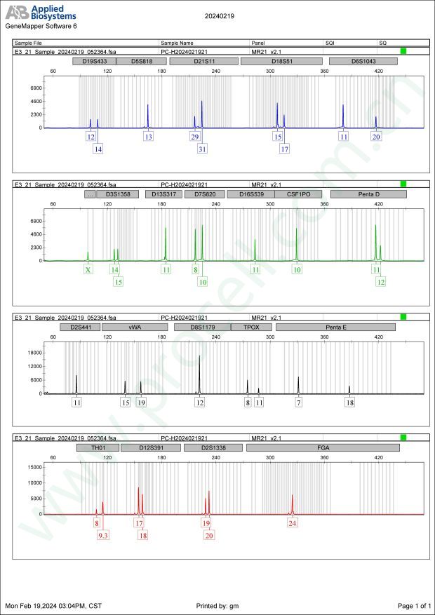 SK-NEP-1（人肾母细胞瘤细胞）