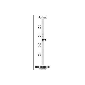 CRELD2 antibody - N - terminal region (OAAB14519) in Jurkat using Western Blot