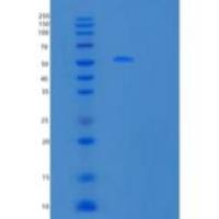人低密度脂蛋白受体相关蛋白12(LRP12)重组蛋白C-6His