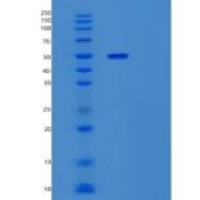 人细胞程序性死亡蛋白1配体1(PDL1)重组蛋白C-mFc