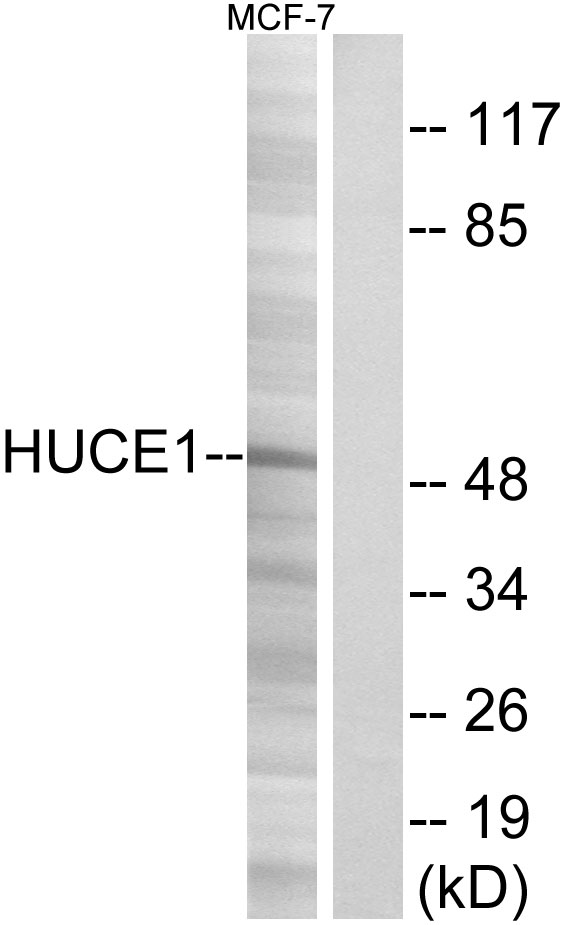 RRP8 Antibody (OAAF03478) in MCF-7 using Western blot.