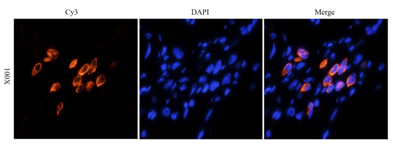 HE4 Antibody (OABI00004) in Human ovarian cancer tissue using Immunofluorescence