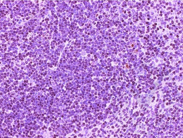 CD4 Antibody (OABF00238) in Human kidney using Immunohistochemistry