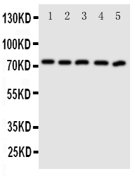 ABCG5 Antibody - N-terminal region (OABB01017) in MCF-7 Whole Cell Lysate, A549 Whole Cell Lysate, HT1080 Whole Cell Lysate, U87 Whole Cell Lysate, SKOV Whole Cell Lysate using Western Blot
