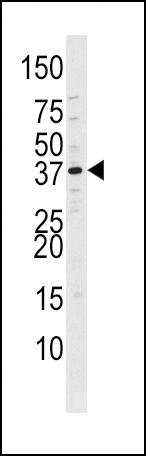 Phospho-CDK7-T170 Antibody (OAAB16026) in Ramos tissue using Western Blot