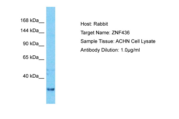 ZNF436 Antibody - middle region (ARP72335_P050) in Human ACHN using Western Blot