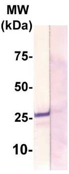 Rabbit Anti-Claudin 12 Polyclonal Antibody(OAAI00027) in MCF-7 using Western Blot.