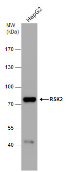 RPS6KA3 Antibody (OAGA02557) in Various whole cell extracts using Western Blot