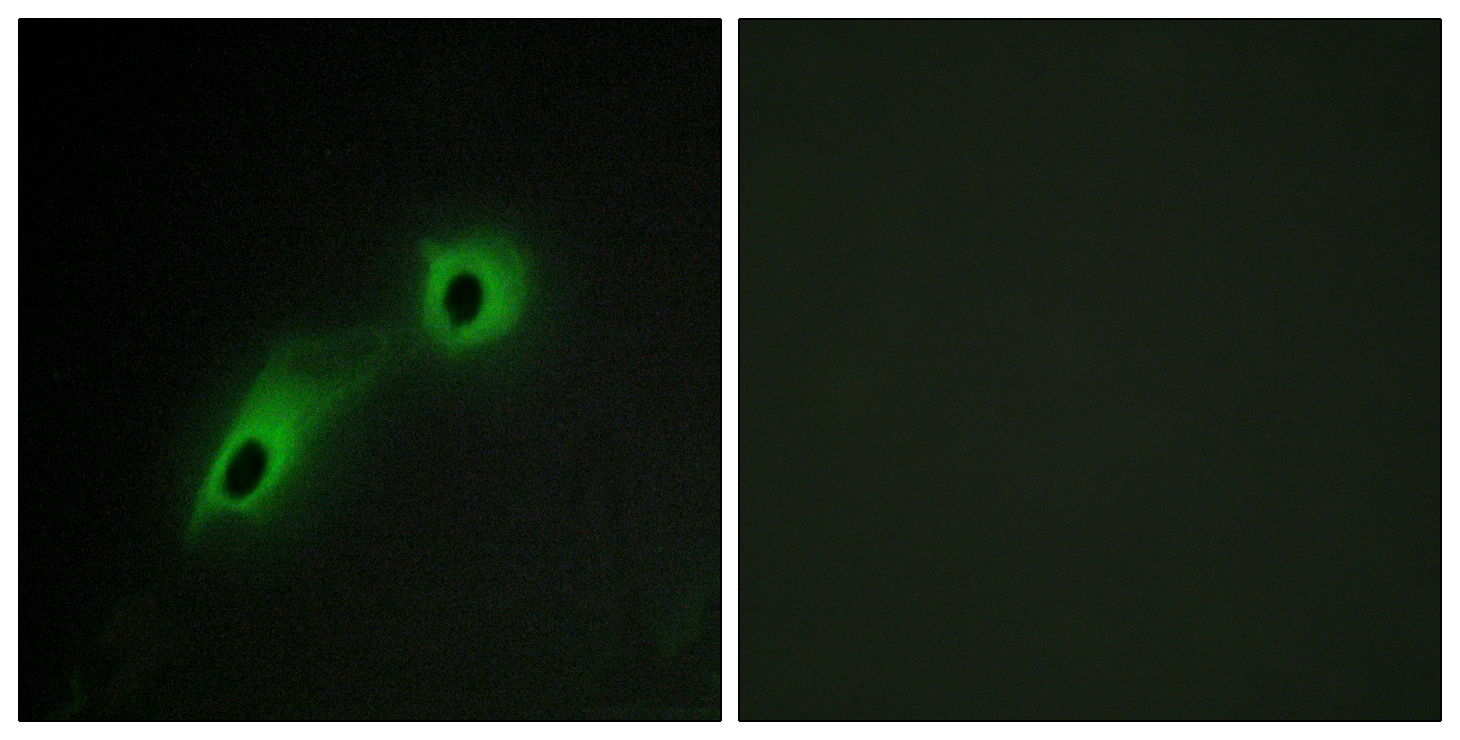 CAMKV Antibody (OAAF02547) in HeLa using Immunofluorescence.