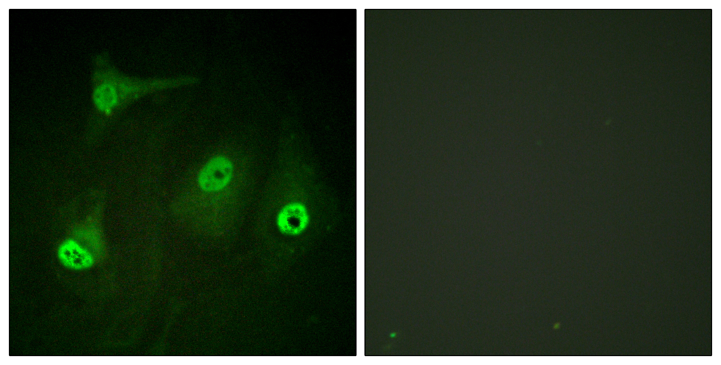 NF-kappaB p65 Antibody (Acetyl-Lys310) (OAAF08188) in HeLa using Immunofluorescence
