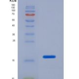 人半乳糖凝集素1(GAL1)重组蛋白