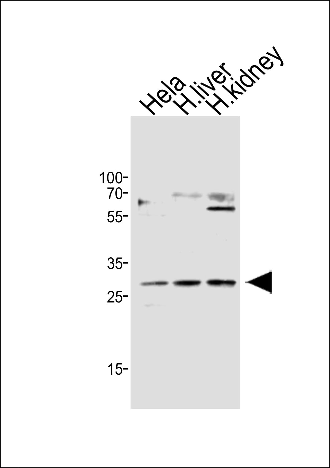 CISH Antibody (OAAB19581) in Hela cell line, human liver, human kidney tissue lysate using Western Blot