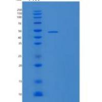 人泛素羧基末端水解酶14/USP14重组蛋白N-6His