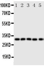 AQP9 Antibody - C-terminal region (OABB01249) in Mouse Liver Tissue Lysate, Mouse Lung Tissue Lysate, Mouse Spleen Tissue Lysate, Mouse Testis Tissue Lysate, PC-12 Whole Cell Lysate using Western Blot