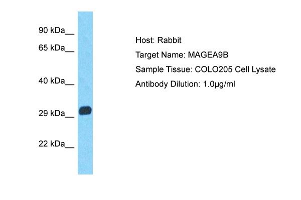 MAGEA9B Antibody - N-terminal region (ARP72269_P050) in Human COLO205 using Western Blot