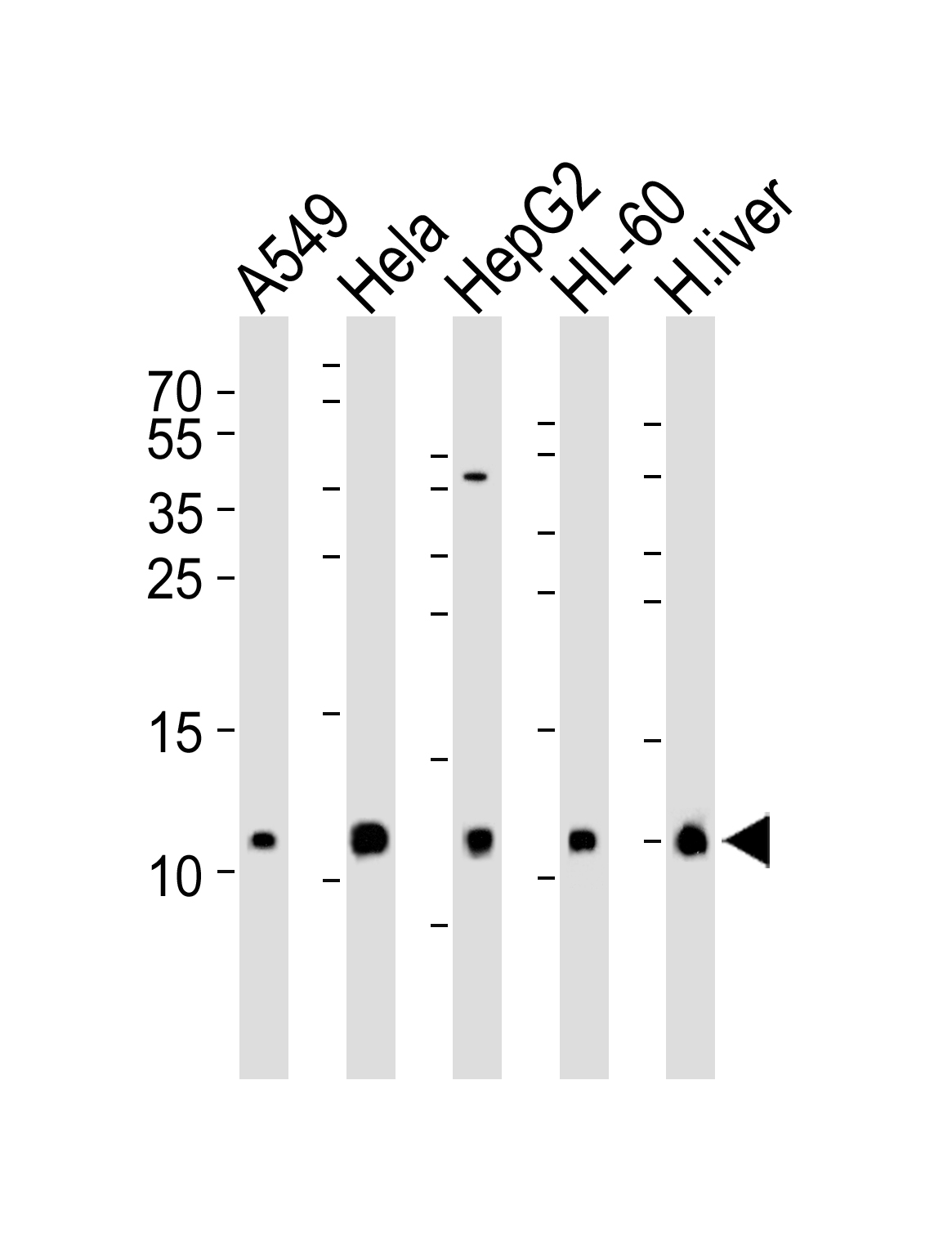 COX6B1 Antibody - N-terminal (OAAB18146) in A549, Hela, HepG2, HL-60 cell line and human liver tissue lysate (from left to right) using Western Blot
