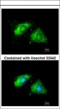 CANX Antibody - middle region (OAGA01669) in Methanol-fixed Hela using Immunofluorescence