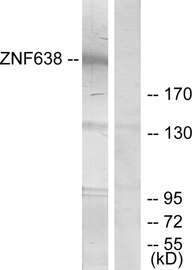 ZNF638 Antibody (OAAF02437) in HepG2 using Western blot.