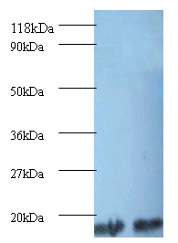 Rabbit anti- human Peptidyl-prolyl cis-trans isomerase A (OACA01491) in EC109 , 293T using Western Blot