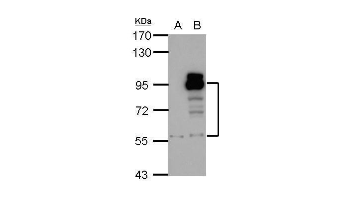 PDE4D antibody (OAGA00330) in A431 , HeLa  using Western Blot