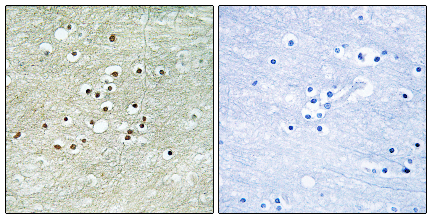 NPAS4 Antibody (OAAF03924) in human brain tissue using Immunohistochemistry.