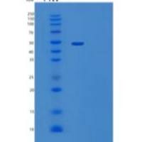 人FTLS / RSPO2重组蛋白186 Leu/Pro, Fc tag