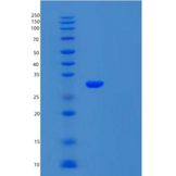 人Carbonic Anhydrase 7/CA7重组蛋白C-6His产品图