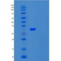 人Carbonic Anhydrase 7/CA7重组蛋白C-6His