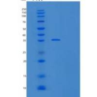 人高温需求蛋白-2重组蛋白