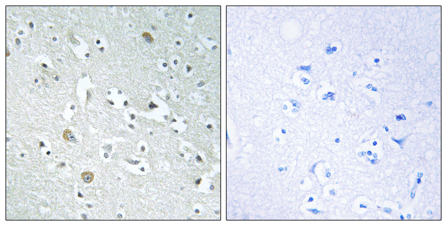 PLA1A Antibody (OAAF04012) in human brain using Immunohistochemistry.