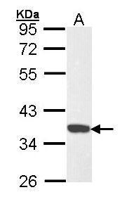 CDK6 Antibody (OAGA02236) in Hela using Western Blot