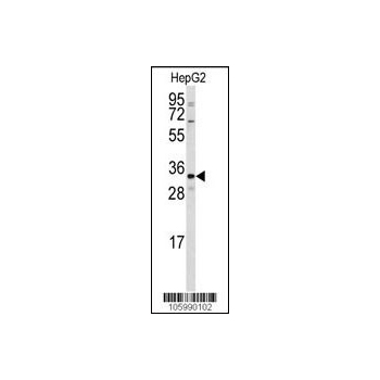 CTDSP2 antibody - N - terminal region (OAAB17631) in HepG2 using Western Blot